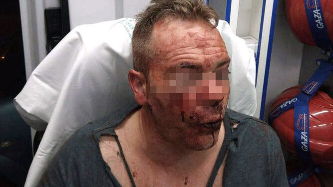 El policía nacional agredido: "sentí mucho miedo"