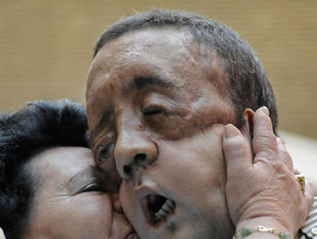 Rafael y su madre se abrazan tras la comparecencia del paciente tras ser dado de alta.

Foto: Juan Carlos V&aacute;zquez