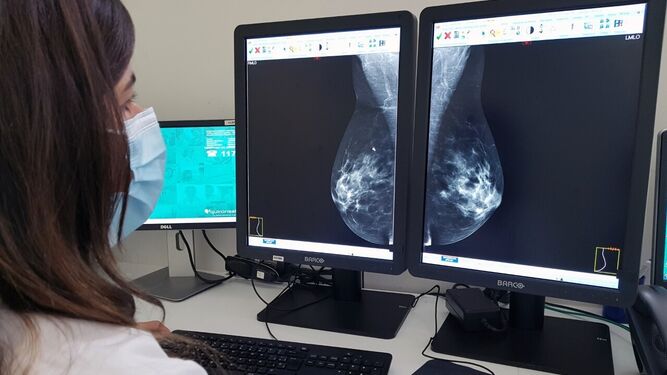 Una doctora observa una mamografía.