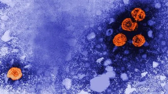Hepatitis infantil aguda sin causa aún conocida