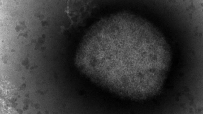 Imagen microscópica del virus causante de la viruela del mono, cuya secuenciación completa han logrado investigadores del Instituto de Salud Carlos III. Fotografía cedida por el Instituto de Salud Carlos III