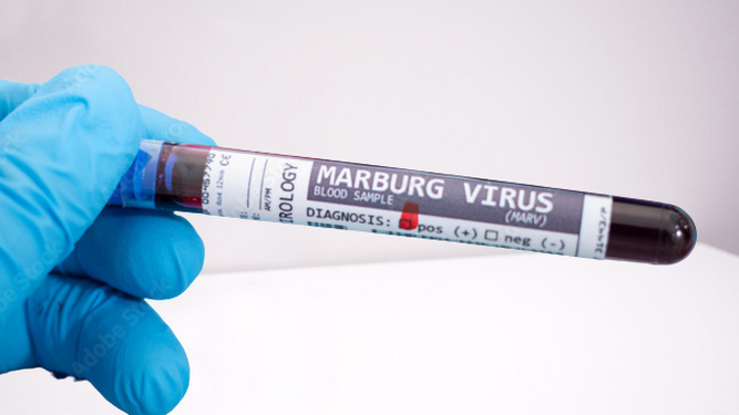 El protocolo de Sanidad para combatir la posible expansión del virus de Marburgo en España