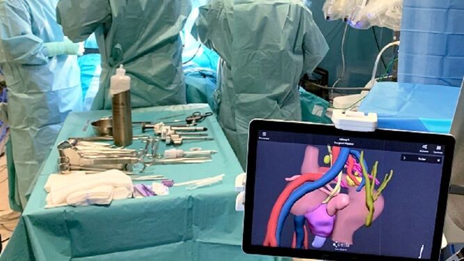 Cirugía (3D) para eliminar lesiones de la enfermedad de Crohn.