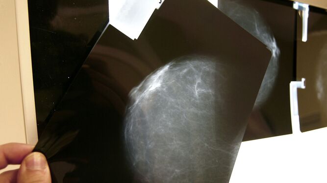Una prueba radiológica de mama.